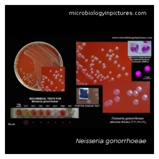 n.gonorrhoeae